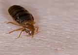 Pictures of Bed Bug Photos Pictures of Bed Bug Photos