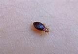 Image Of Bed Bug Images
