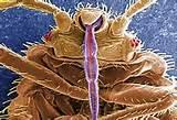 Images Of Bed Bugs Photos