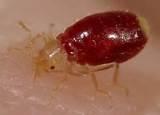 Images of Do Bed Bugs Itch