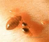 Images of Bed Bugs Infestation
