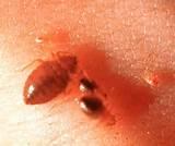 Images of Symptoms Of Bed Bugs
