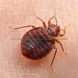 Treatment Of Bed Bugs Images