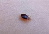 Treatment Bed Bugs Images