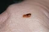 Causes Of Bed Bugs Photos