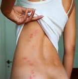 Images of Preventing Bed Bugs