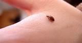 Photos of Bed Bugs Causes