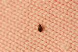 Photos of Getting Rid Of Bed Bugs