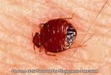 Bed Bug Information