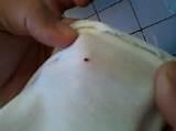 Images of Where Are Bed Bugs Found