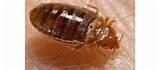 Bed Bugs Hair Pictures Bed Bugs Hair Pictures