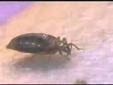 Pictures of Bed Bugs Concern Pictures of Bed Bugs Concern